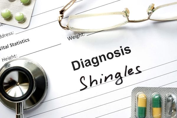 What is Shingles